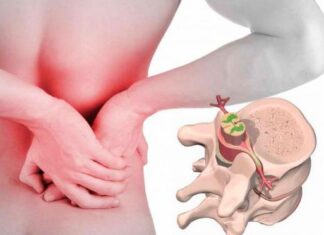 Основные причины развития: почему возникают грыжа дисков и спондилоартроз