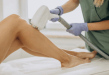 Почему выбирают лазерную эпиляцию: плюсы перед другими методами