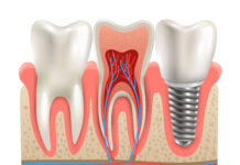 MedSnab – Ваш надежный партнер в оснащении стоматологии