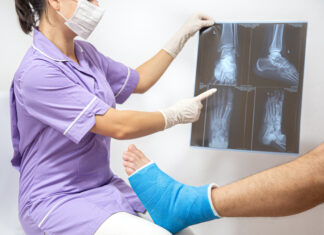 Травматолог-ортопед — когда записываться на прием